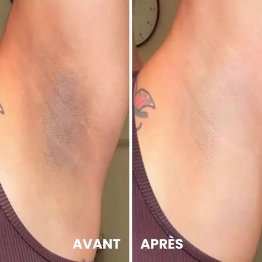 كريم التبييض